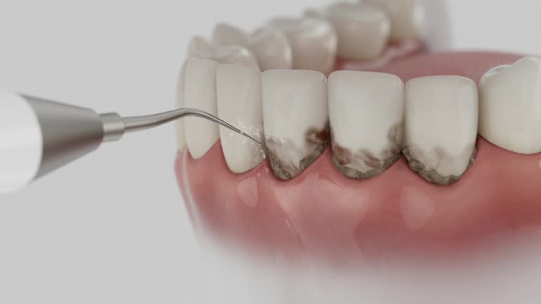 Reliable Tooth Extraction contractor in Tiltonsville, OH by Smile Center Dentistry